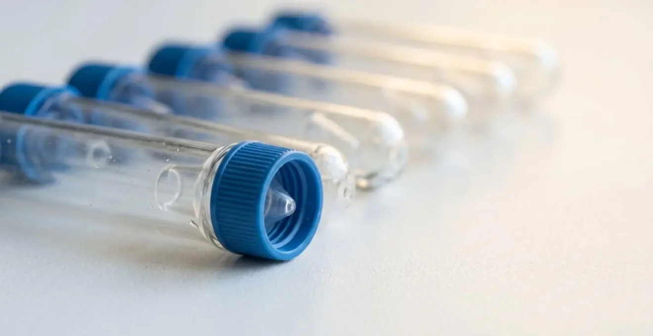 Four-point saliva collection tubes for cortisol rhythm testing